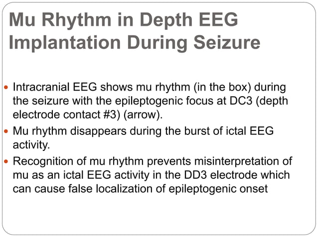 Mu rhythm | PPTX | Children\'s Music | Music