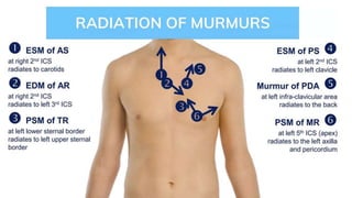 • DURATION
• RADIATION
 