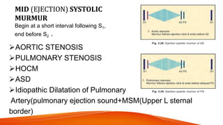 MID (EJECTION) SYSTOLIC
MURMUR
Begin at a short interval following S1,
end before S2 .
AORTIC STENOSIS
PULMONARY STENOSIS
HOCM
ASD
Idiopathic Dilatation of Pulmonary
Artery(pulmonary ejection sound+MSM(Upper L sternal
border)
 