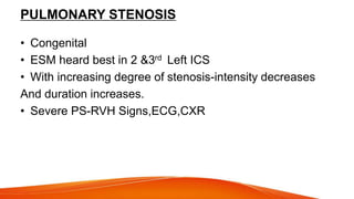 PULMONARY STENOSIS
• Congenital
• ESM heard best in 2 &3rd Left ICS
• With increasing degree of stenosis-intensity decreases
And duration increases.
• Severe PS-RVH Signs,ECG,CXR
 