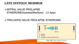 LATE SYSTOLIC MURMUR
MITRAL VALVE PROLAPSE
SYNDROME(Isolated/Marfans)- LV Apex
TRICUSPID VALVE PROLAPSE SYNDROME
 