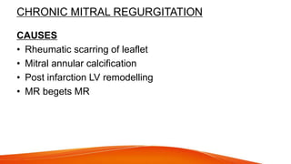 CHRONIC MITRAL REGURGITATION
CAUSES
• Rheumatic scarring of leaflet
• Mitral annular calcification
• Post infarction LV remodelling
• MR begets MR
 