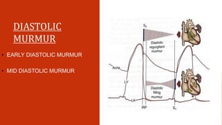 DIASTOLIC
MURMUR
• EARLY DIASTOLIC MURMUR
• MID DIASTOLIC MURMUR
 