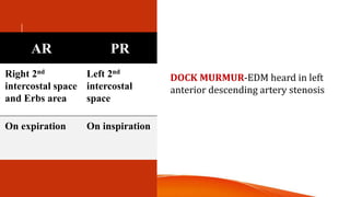 •
AR PR
Right 2nd
intercostal space
and Erbs area
Left 2nd
intercostal
space
On expiration On inspiration
DOCK MURMUR-EDM heard in left
anterior descending artery stenosis
 