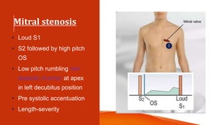 Mitral stenosis
• Loud S1
• S2 followed by high pitch
OS
• Low pitch rumbling mid
diastolic murmur at apex
in left decubitus position
• Pre systolic accentuation
• Length-severity
 