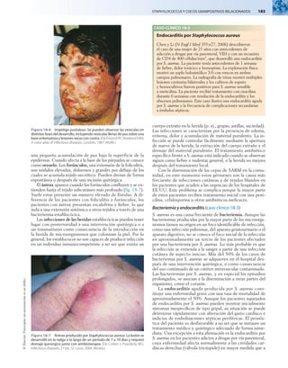STAPHYLOCOCCUS Y COCOS GRAMPOSITIVOS RELACIONADOS   183
©
Elsevier.
Fotocopiar
sin
autorización
es
un
delito.
una pequeña acumulación de pus bajo la superficie de la
epidermis. Cuando afecta a la base de los párpados se conoce
como orzuelo. Los forúnculos, una extensión de la foliculitis,
son nódulos elevados, dolorosos y grandes por debajo de los
cuales se acumula tejido necrótico. Pueden drenar de forma
espontánea o después de una incisión quirúrgica.
El ántrax aparece cuando los forúnculos confluyen y se ex-
tienden hasta el tejido subcutáneo más profundo (fig. 18-7).
Suele estar presente un número elevado de fístulas. A di-
ferencia de los pacientes con foliculitis y forúnculos, los
pacientes con ántrax presentan escalofríos y fiebre, lo que
indica una extensión sistémica a otros tejidos a través de una
bacteriemia estafilocócica.
Las infecciones de las heridas estafilocócicas pueden tener
lugar con posterioridad a una intervención quirúrgica o a
un traumatismo como consecuencia de la introducción en
la herida de microorganismos que colonizan la piel. Por lo
general, los estafilococos no son capaces de producir infección
en un individuo inmunocompetente a no ser que exista un
cuerpo extraño en la herida (p. ej., grapas, astillas, suciedad).
Las infecciones se caracterizan por la presencia de edema,
eritema, dolor y acumulación de material purulento. La in-
fección se puede controlar fácilmente mediante la apertura
de nuevo de la herida, la extracción del cuerpo extraño y el
drenaje del material purulento. El tratamiento antibiótico
específico frente a S. aureus está indicado cuando se observan
signos como fiebre o malestar general, o la herida no mejora
después del tratamiento local.
Con la diseminación de las cepas de SARM en la comu-
nidad, en este momento estos gérmenes son la causa más
frecuente de infecciones cutáneas y de tejidos blandos en
los pacientes que acuden a las urgencias de los hospitales de
EE.UU. Este problema se complica porque la mayor parte
de estos pacientes reciben tratamiento inicial con una peni-
cilina, cefalosporina u otros antibióticos ineficaces.
Bacteriemia y endocarditis (caso clínico 18-3)
S. aureus es una causa frecuente de bacteriemia. Aunque las
bacteriemias producidas por la mayor parte de los microorga-
nismos tienen su origen en un foco identificable de infección,
como una infección pulmonar, del aparato genitourinario o el
aparato digestivo, no se conoce el foco inicial de la infección
en aproximadamente un tercio de los pacientes afectados
por una bacteriemia por S. aureus. Lo más probable es que
la infección se extienda a la sangre a partir de una infección
cutánea de aspecto inocuo. Más del 50% de los casos de
bacteriemia por S. aureus se adquieren en el hospital des-
pués de una intervención quirúrgica, o como consecuencia
del uso continuado de un catéter intravascular contaminado.
Las bacteriemias por S. aureus, y en especial los episodios
prolongados, se asocian a la diseminación a otras partes del
organismo, como el corazón.
La endocarditis aguda producida por S. aureus cons-
tituye una enfermedad grave con una tasa de mortalidad de
aproximadamente el 50%. Aunque los pacientes aquejados
de endocarditis por S. aureus pueden mostrar inicialmente
síntomas inespecíficos de tipo gripal, su situación se puede
deteriorar rápidamente con alteración del gasto cardíaco e
indicios de embolizaciones sépticas periféricas. El pronós-
tico del paciente es desfavorable a no ser que se instaure un
tratamiento médico y quirúrgico adecuado de forma inme-
diata. Una excepción a esta afirmación es la endocarditis por
S. aureus en los pacientes adictos a drogas por vía parenteral,
cuya enfermedad afecta normalmente a las cavidades car-
díacas derechas (válvula tricúspide) en mayor medida que a
Figura 18-6  Impétigo pustuloso. Se pueden observar las vesículas en
distintas fases del desarrollo, incluyendo vesículas llenas de pus sobre una
base eritematosa y lesiones secas con costra. (De Emond RT, Rowland HAK:
A color atlas of infectious diseases, Londres, 1987, Wolfe.)
Figura 18-7  Ántrax producido por Staphylococcus aureus. La lesión se
desarrolló en la nalga a lo largo de un período de 7 a 10 días y requirió
drenaje quirúrgico junto con antibioterapia. (De Cohen J, Powderly WG:
Infectious diseases, 2.ª ed., St. Louis, 2004, Mosby.)
CASO CLÍNICO 18-3
Endocarditis por Staphylococcus aureus
Chen y Li (N Engl J Med 355:e27, 2006) describieron
el caso de una mujer de 21 años con antecedentes de
adicción a drogas por vía parenteral, VIH y con un recuento
de CD4 de 400 células/mm3
, que desarrolló una endocarditis
por S. aureus. La paciente tenía antecedentes de 1 semana
de fiebre, dolor torácico y hemoptisis. La exploración física
mostró un soplo holosistólico 3/6 con roncos en ambos
campos pulmonares. La radiografía de tórax mostró múltiples
lesiones cavitarias bilaterales y los cultivos de esputo
y hemocultivos fueron positivos para S. aureus sensible
a meticilina. La paciente recibió tratamiento con oxacilina
durante 6 semanas con resolución de la endocarditis y los
abscesos pulmonares. Este caso ilustra una endocarditis aguda
por S. aureus y la frecuencia de complicaciones secundarias
a émbolos sépticos.
 