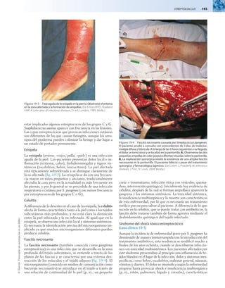 Streptococcus  193
©
Elsevier.
Fotocopiar
sin
autorización
es
un
delito.
estar implicados algunos estreptococos de los grupos C y G.
Staphylococcus aureus aparece con frecuencia en las lesiones.
Las cepas estreptocócicas que provocan infecciones cutáneas
son diferentes de las que causan faringitis, aunque los sero-
tipos del pioderma pueden colonizar la faringe y dar lugar a
un estado de portador permanente.
Erisipela
La erisipela (eritros, «rojo»; pella, «piel») es una infección
aguda de la piel. Los pacientes presentan dolor local e in-
flamación (eritema, calor), linfadenomegalia y signos sis-
témicos (escalofríos, fiebre, leucocitosis). La piel afectada
está típicamente sobreelevada y se distingue claramente de
la no afectada (fig. 19-3). La erisipela se da con una frecuen-
cia mayor en niños pequeños y ancianos, tradicionalmente
afectaba la cara pero en la actualidad es más frecuente en
las piernas, y por lo general se ve precedida de una infección
respiratoria o cutánea por S. pyogenes (con menor frecuencia
por estreptococos de los grupos C o G).
Celulitis
A diferencia de lo descrito en el caso de la erisipela, la celulitis
afecta de forma característica tanto a la piel como a los tejidos
subcutáneos más profundos, y no está clara la distinción
entre la piel infectada y la no infectada. Al igual que en la
erisipela, se observa una infección local y síntomas sistémicos.
Es necesaria la identificación precisa del microorganismo im-
plicado ya que muchos microorganismos diferentes pueden
producir celulitis.
Fascitis necrosante
La fascitis necrosante (también conocida como gangrena
estreptocócica) es una infección que se desarrolla en la zona
profunda del tejido subcutáneo, se extiende a través de los
planos de las fascias y se caracteriza por una extensa des-
trucción de los músculos y el tejido adiposo (fig. 19-4). El
microorganismo (conocido en medios de comunicación como
bacterias necrosantes) se introduce en el tejido a través de
una solución de continuidad de la piel (p. ej., un pequeño
corte o traumatismo, infección vírica con vesículas, quema-
dura, intervención quirúrgica). Inicialmente hay evidencia de
celulitis, después de la cual se forman ampollas y aparecen la
gangrena y los síntomas sistémicos. La toxicidad sistémica,
la insuficiencia multiorgánica y la muerte son características
de esta enfermedad, por lo que es necesario un tratamiento
médico precoz para salvar al paciente. A diferencia de lo que
sucede en la celulitis, que se puede tratar con antibióticos, la
fascitis debe tratarse también de forma agresiva mediante el
desbridamiento quirúrgico del tejido infectado.
Síndrome del shock tóxico estreptocócico
(caso clínico 19-1)
Aunque la incidencia de enfermedad grave por S. pyogenes ha
disminuido de manera ininterrumpida tras la introducción del
tratamiento antibiótico, esta tendencia se modificó mucho a
finales de los años ochenta, cuando se describieron infeccio-
nes con toxicidad multisistémica. Los pacientes afectados por
este síndrome presentaban al principio una inflamación de te-
jidos blandos en el lugar de la infección, dolor y síntomas ines-
pecíficos, como fiebre, escalofríos, malestar general, náuseas,
vómitos y diarrea. El dolor se intensifica según la enfermedad
progresa hasta provocar shock e insuficiencia multiorgánica
(p. ej., riñón, pulmones, hígado y corazón), características
Figura19-3  Fase aguda de la erisipela en la pierna. Obsérvese el eritema
en la zona afectada y la formación de ampollas. (De Emond RTD, Rowland
HAK: A color atlas of infectious diseases, 2.ª ed., Londres, 1989, Wolfe.)
Figura 19-4  Fascitis necrosante causada por Streptococcus pyogenes.
El paciente acudió a consulta con antecedentes de 3 días de malestar,
mialgia difusa y febrícula. A lo largo de las 3 horas siguientes a su llegada,
el dolor se tornó atroz y se localizó en la pantorrilla. A, Obsérvense las dos
pequeñas ampollas de color púrpura (flechas) situadas sobre la pantorrilla.
B, La exploración quirúrgica reveló la existencia de una amplia fascitis
necrosante en la pantorrilla. El paciente falleció a pesar del tratamiento
quirúrgico y farmacológico agresivo. (De Cohen J, Powderly W: Infectious
diseases, 2.ª ed., St. Louis, 2004, Mosby.)
 