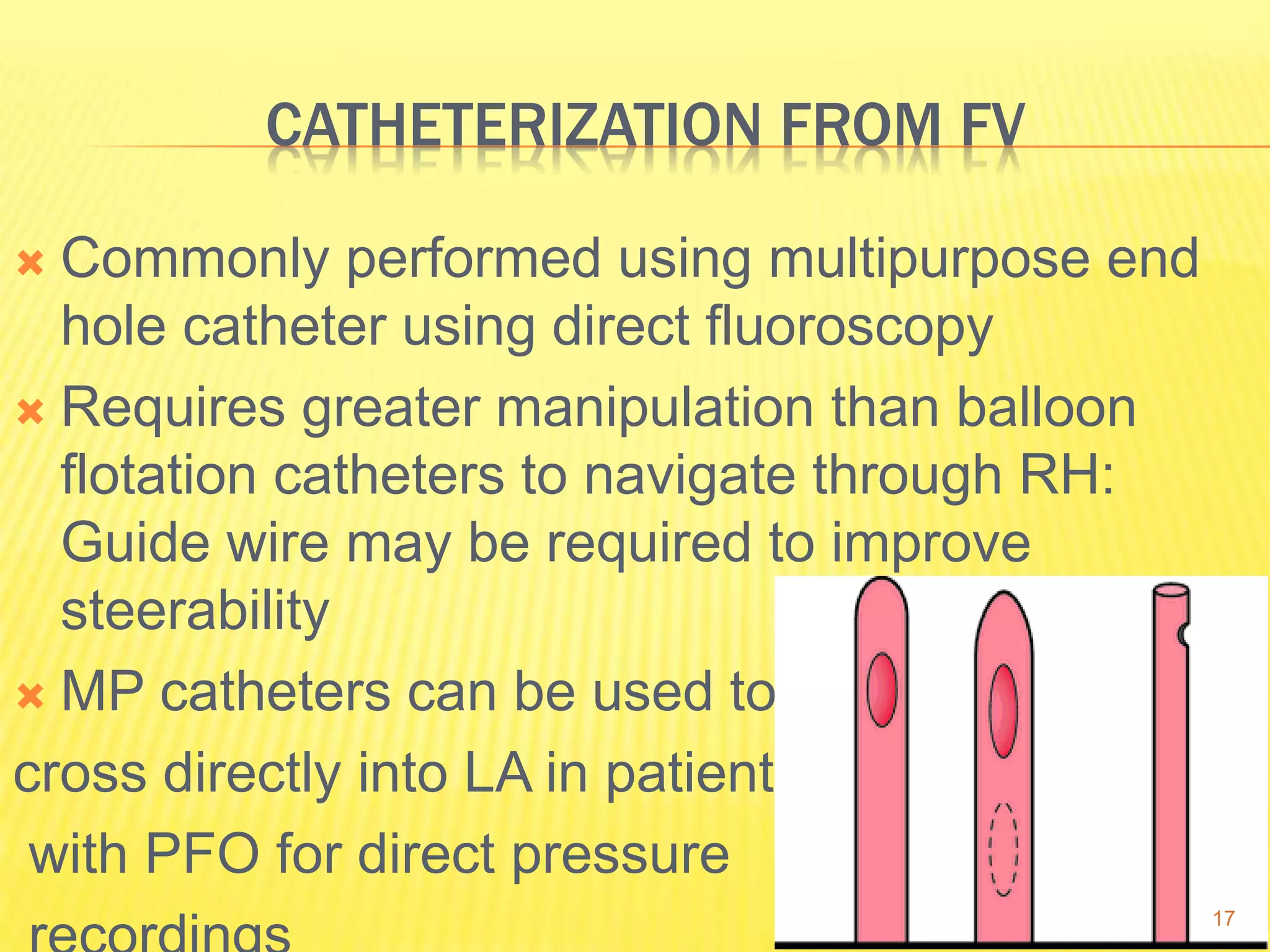 CATHETERIZATION FROM FV
 Commonly performed using multipurpose end
hole catheter using direct fluoroscopy
 Requires greater manipulation than balloon
flotation catheters to navigate through RH:
Guide wire may be required to improve
steerability
 MP catheters can be used to
cross directly into LA in patients
with PFO for direct pressure
17
 