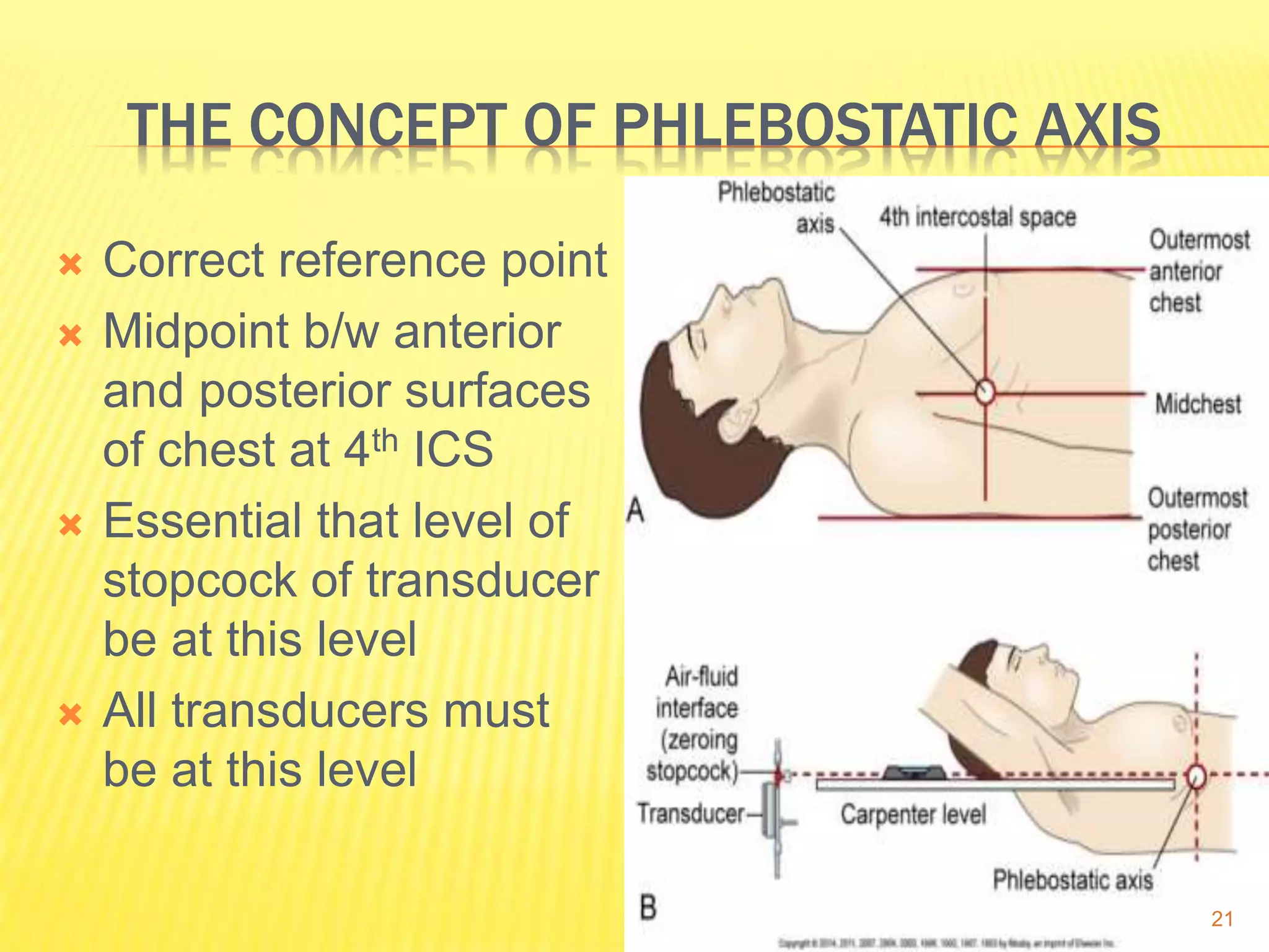 THE CONCEPT OF PHLEBOSTATIC AXIS
 Correct reference point
 Midpoint b/w anterior
and posterior surfaces
of chest at 4th ICS
 Essential that level of
stopcock of transducer
be at this level
 All transducers must
be at this level
21
 