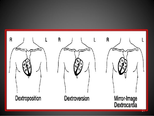 an analysis of heart disease Purpose of review genome-wide analysis of rna abundances (transcriptome analysis) offers great potential to identify biomarkers of disease and to gain insight. an analysis of heart disease Purpose of review genome-wide analysis of rna abundances (transcriptome analysis) offers great potential to identify biomarkers of disease and to gain insight.