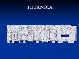 TETÁNICA 