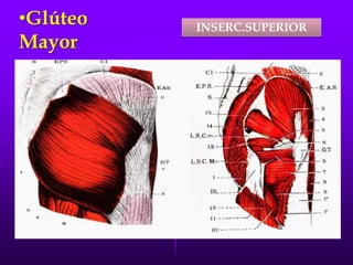 •Glúteo
Mayor
INSERC.SUPERIOR
 