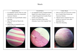 Skeleton Smooth Difference Between Cardiac Skeletal And Smooth Muscle
