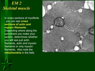 EM 2
Skeletal muscle
In cross sections of myofibrils
, you can see cross
sections of actin and
myosin filaments.
Depending where along the
sarcomere you make your
section, determines whether
you will see just actin
filaments, actin and myosin
filaments or only myosin
filaments. Also note the
mitochondria in the field.

 