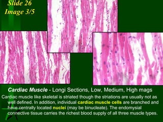 Slide 26
Image 3/5

Cardiac Muscle - Longi Sections, Low, Medium, High mags
Cardiac muscle like skeletal is striated though the striations are usually not as
well defined. In addition, individual cardiac muscle cells are branched and
have centrally located nuclei (may be binucleate). The endomysial
connective tissue carries the richest blood supply of all three muscle types.

 