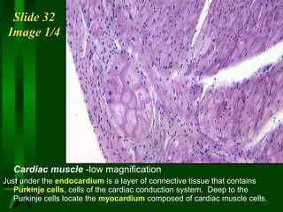 Slide 32
Image 1/4

Cardiac muscle -low magnification
Just under the endocardium is a layer of connective tissue that contains
Purkinje cells, cells of the cardiac conduction system. Deep to the
Purkinje cells locate the myocardium composed of cardiac muscle cells.

 