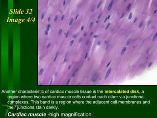 Slide 32
Image 4/4

Another characteristic of cardiac muscle tissue is the intercalated disk, a
region where two cardiac muscle cells contact each other via junctional
complexes. This band is a region where the adjacent cell membranes and
their junctions stain darkly.

Cardiac muscle -high magnification

 