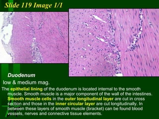 Slide 119 Image 1/1

Duodenum
low & medium mag.
The epithelial lining of the duodenum is located internal to the smooth
muscle. Smooth muscle is a major component of the wall of the intestines.
Smooth muscle cells in the outer longitudinal layer are cut in cross
section and those in the inner circular layer are cut longitudinally. In
between these layers of smooth muscle (bracket) can be found blood
vessels, nerves and connective tissue elements.

 