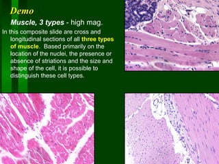 Demo
Muscle, 3 types - high mag.
In this composite slide are cross and
longitudinal sections of all three types
of muscle. Based primarily on the
location of the nuclei, the presence or
absence of striations and the size and
shape of the cell, it is possible to
distinguish these cell types.

 
