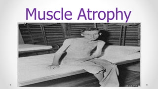 Muscle Atrophy
 