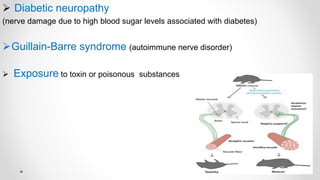  Diabetic neuropathy
(nerve damage due to high blood sugar levels associated with diabetes)
Guillain-Barre syndrome (autoimmune nerve disorder)
 Exposure to toxin or poisonous substances
 