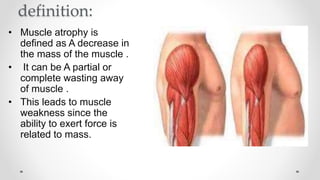 definition:
• Muscle atrophy is
defined as A decrease in
the mass of the muscle .
• It can be A partial or
complete wasting away
of muscle .
• This leads to muscle
weakness since the
ability to exert force is
related to mass.
 