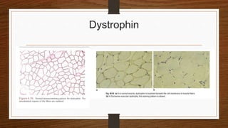 Dystrophin
 