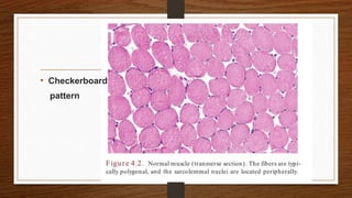 • Checkerboard
pattern
 