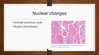 Nuclear changes
• Normally peripheral nuclei
• Nuclear internalisation
 