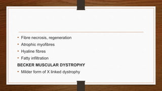 • Fibre necrosis, regeneration
• Atrophic myofibres
• Hyaline fibres
• Fatty infiltration
BECKER MUSCULAR DYSTROPHY
• Milder form of X linked dystrophy
 