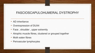 FASCIOSCAPULOHUMERAL DYSTROPHY
• AD inheritance
• Overexpression of DUX4
• Face , shoulder , upper extremity
• Atrophic muscle fibres, clustered or grouped together
• Moth eaten fibres
• Perivascular lymphocytes
 