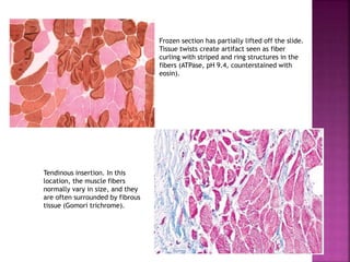 muscle biopsy site indications staining processing of muscle biopsy.pptx