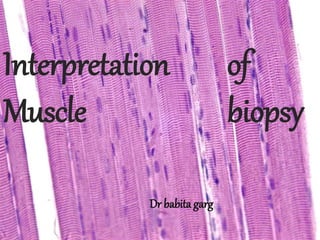 Interpretation of
Muscle biopsy
Dr babita garg
 
