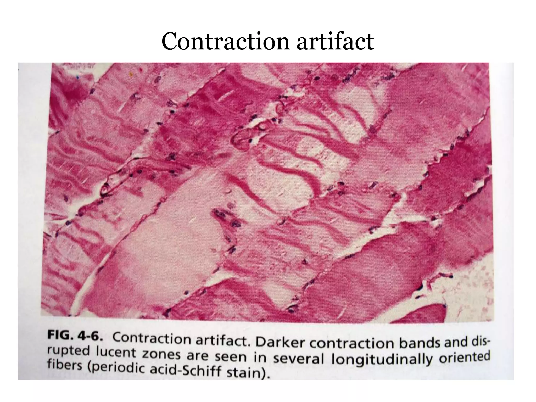 Muscle biopsy interpretation | PPTX