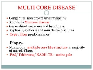 MULTI CORE DISEASE
 Congenital, non progressive myopathy
 Known as Minicore disease
 Generalised weakness and hypotonia.
 Kyphosis, scoliosis and muscle contractures
 Type 1 fiber predominance.
Biopsy-
 Numerous , multiple core like structure in majority
of muscle fibers.
 PAS/ Trichrome/ NADH-TR – stains pale
 