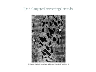 EM : elongated or rectangular rods
 