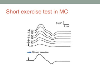 Short exercise test in MC
 