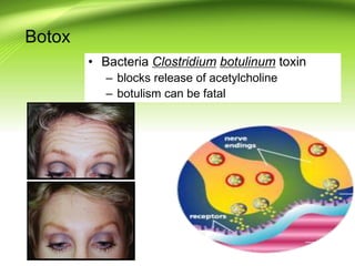 Botox
• Bacteria Clostridium botulinum toxin
– blocks release of acetylcholine
– botulism can be fatal
 