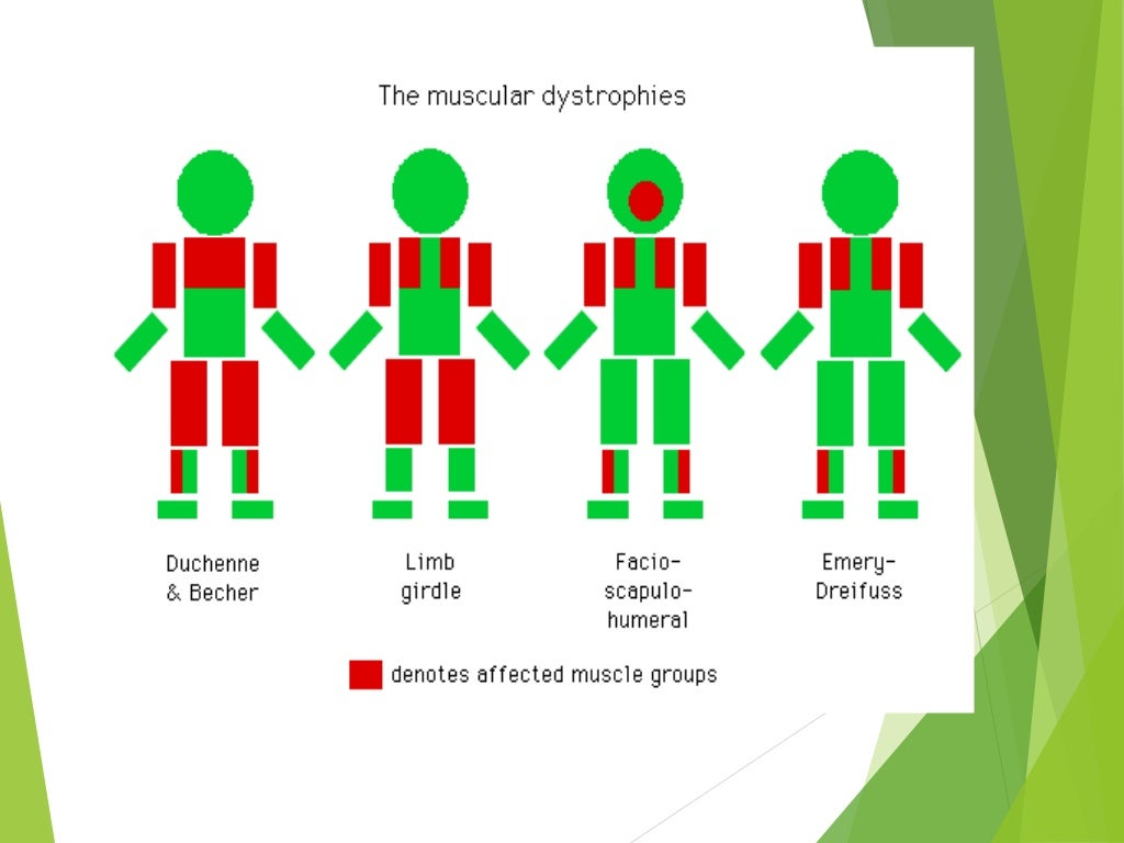 Muscle diseases