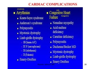 CARDIAC COMPLICATIONS
Rosette Jabbour, MD 28
Arrythmia
CHF
Congestive
 