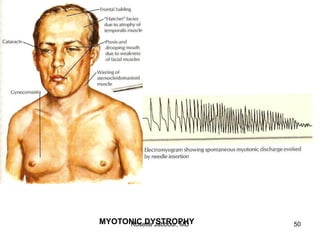 MYOTONIC DYSTROPHY
Rosette Jabbour, MD 50
 