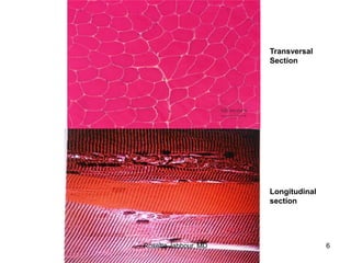 Transversal
Section
Longitudinal
section
Rosette Jabbour, MD 6
 