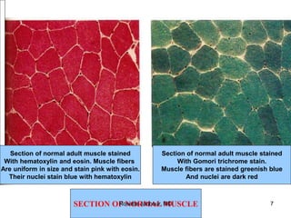 SECTION OF NORMAL MUSCLE
Section of normal adult muscle stained
With hematoxylin and eosin. Muscle fibers
Are uniform in size and stain pink with eosin.
Their nuclei stain blue with hematoxylin
Section of normal adult muscle stained
With Gomori trichrome stain.
Muscle fibers are stained greenish blue
And nuclei are dark red
Rosette Jabbour, MD 7
 