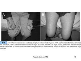 IBM
Rosette Jabbour, MD 75
 