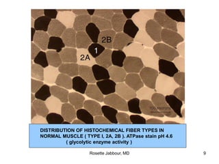 DISTRIBUTION OF HISTOCHEMICAL FIBER TYPES IN
NORMAL MUSCLE ( TYPE I, 2A, 2B ). ATPase stain pH 4.6
( glycolytic enzyme activity )
Rosette Jabbour, MD 9
 