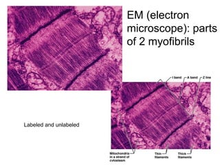 EM (electron
microscope): parts
of 2 myofibrils
Labeled and unlabeled
 