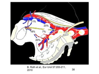38
Where are the regional lymph nodes of the bladder ?
11%
20%
18% 7%
20%
5%
4%4%11%
B. Roth et al., Eur Urol 57:205-211,
2010
 