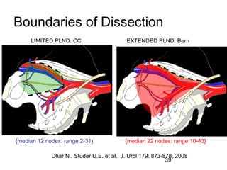 39
LIMITED PLND: CC EXTENDED PLND: Bern
Boundaries of Dissection
{median 12 nodes: range 2-31} {median 22 nodes: range 10-43}
Dhar N., Studer U.E. et al., J. Urol 179: 873-878, 2008
 