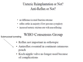 74
Submucosal tunneling
 