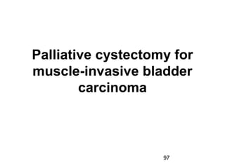 97
Palliative cystectomy for
muscle-invasive bladder
carcinoma
 
